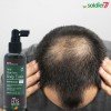 HTS Anti Hair Loss Scalp Tonic