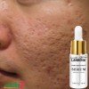 Lanbena Pore Treatment Serum