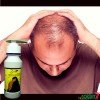 Zafran Hair Growth Therapy